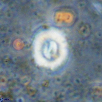 Watznaueria fossacincta VR 20282