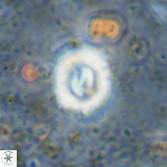 Watznaueria fossacincta VR 20282