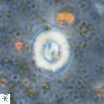 Watznaueria fossacincta VR 20283