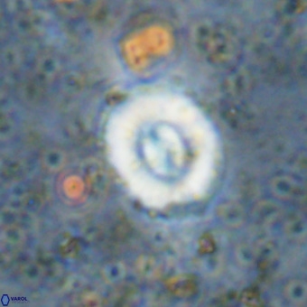 Watznaueria fossacincta VR 20284