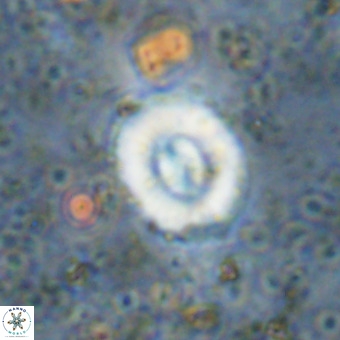 Watznaueria fossacincta VR 20284