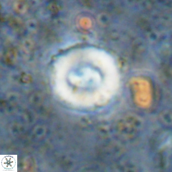 Watznaueria fossacincta VR 20286