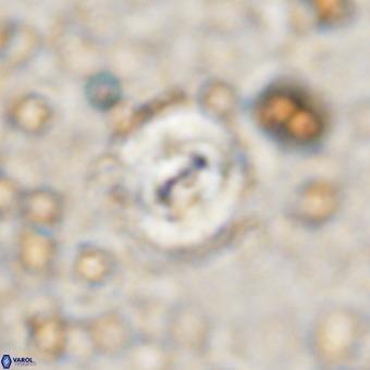 Watznaueria fossacincta VR 20288