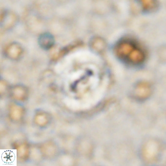 Watznaueria fossacincta VR 20288