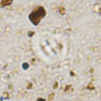 Watznaueria fossacincta VR 20289
