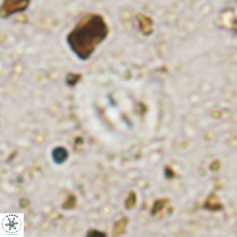 Watznaueria fossacincta VR 20289