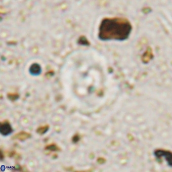 Watznaueria fossacincta VR 20290