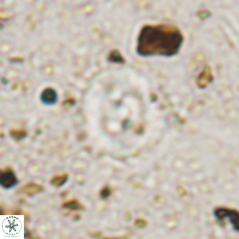 Watznaueria fossacincta VR 20290