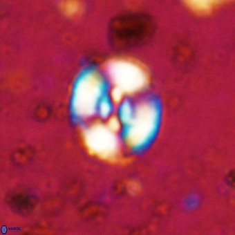 Watznaueria fossacincta VR 20293