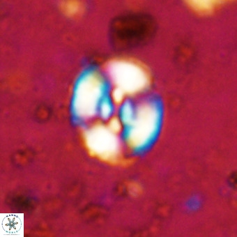 Watznaueria fossacincta VR 20293