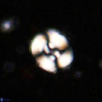 Watznaueria fossacincta VR 20295