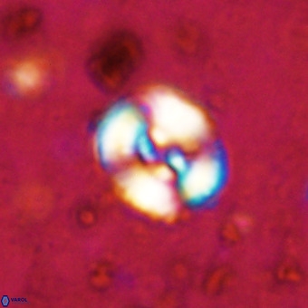 Watznaueria fossacincta VR 20297