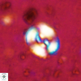 Watznaueria fossacincta VR 20297