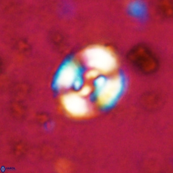 Watznaueria fossacincta VR 20298