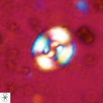 Watznaueria fossacincta VR 20298