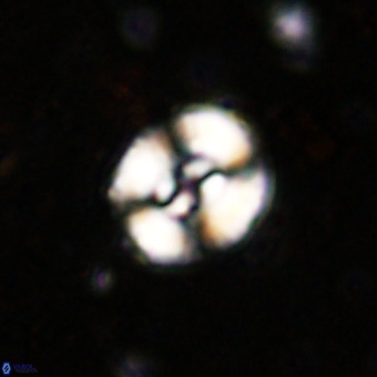 Watznaueria fossacincta VR 20299