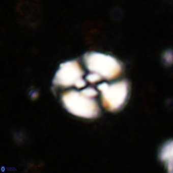 Watznaueria fossacincta VR 20300