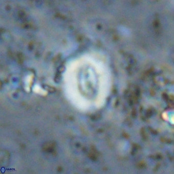 Watznaueria fossacincta VR 20443