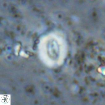 Watznaueria fossacincta VR 20443