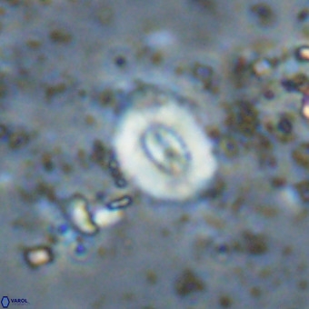 Watznaueria fossacincta VR 20444