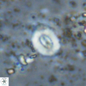 Watznaueria fossacincta VR 20444