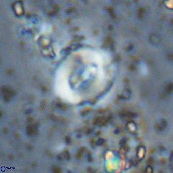 Watznaueria fossacincta VR 20445