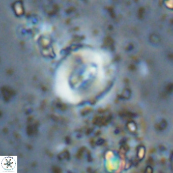 Watznaueria fossacincta VR 20445