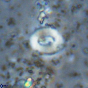 Watznaueria fossacincta VR 20446