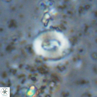 Watznaueria fossacincta VR 20446