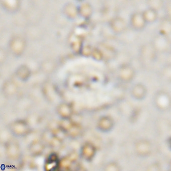 Watznaueria fossacincta VR 20447
