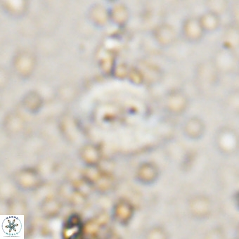 Watznaueria fossacincta VR 20447