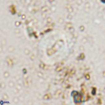Watznaueria fossacincta VR 20449