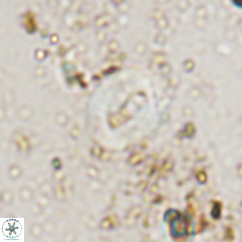 Watznaueria fossacincta VR 20449