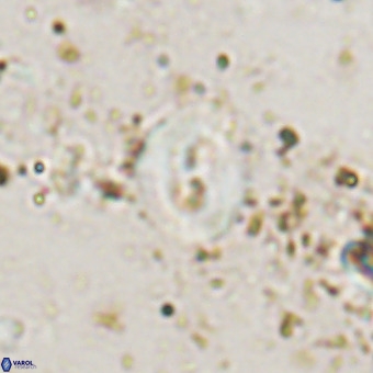Watznaueria fossacincta VR 20450