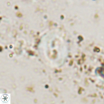 Watznaueria fossacincta VR 20450