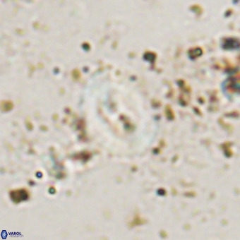 Watznaueria fossacincta VR 20451