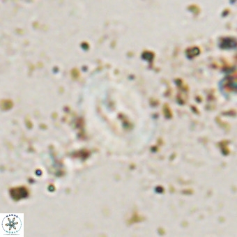 Watznaueria fossacincta VR 20451