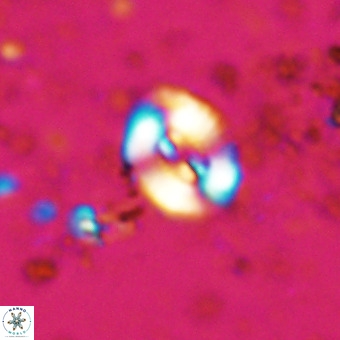 Watznaueria fossacincta VR 20454