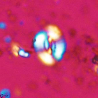 Watznaueria fossacincta VR 20455