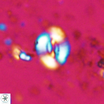 Watznaueria fossacincta VR 20455