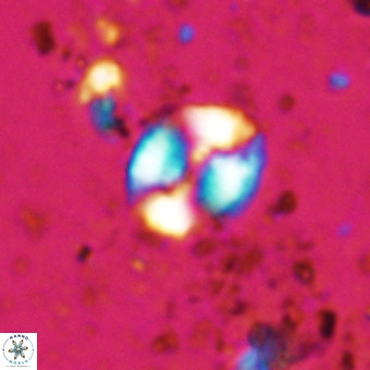 Watznaueria fossacincta VR 20458