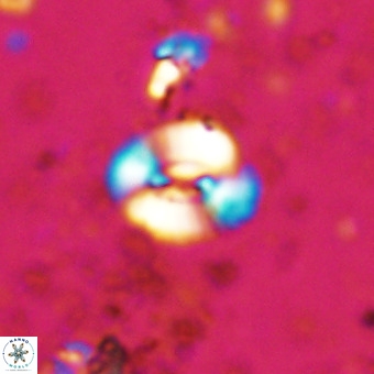 Watznaueria fossacincta VR 20461