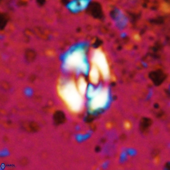 Watznaueria fossacincta VR 20462