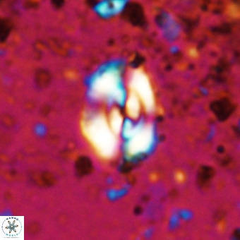 Watznaueria fossacincta VR 20462