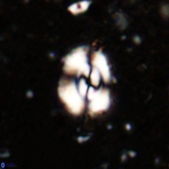 Watznaueria fossacincta VR 20463