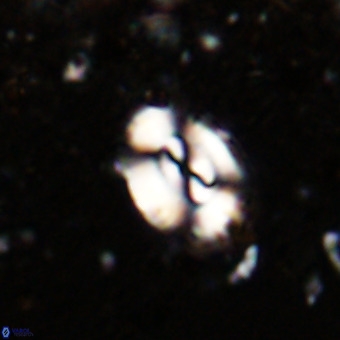Watznaueria fossacincta VR 20464