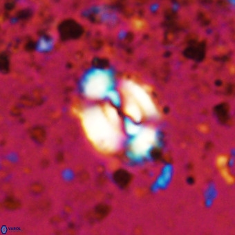 Watznaueria fossacincta VR 20465