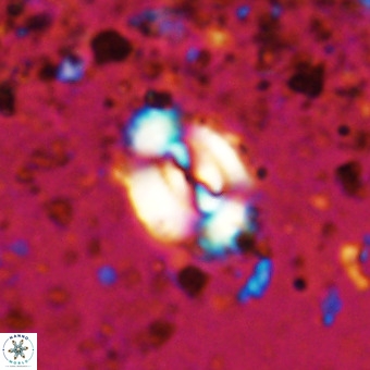 Watznaueria fossacincta VR 20465