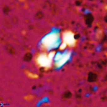 Watznaueria fossacincta VR 20466