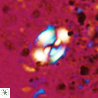 Watznaueria fossacincta VR 20466
